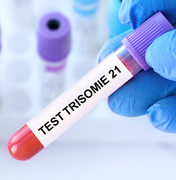 Test Trisomie Palazzo della salute Catenanuova