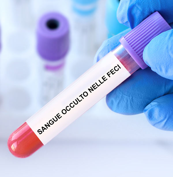 Sangue occulto nelle feci Palazzo della salute Catenanuova